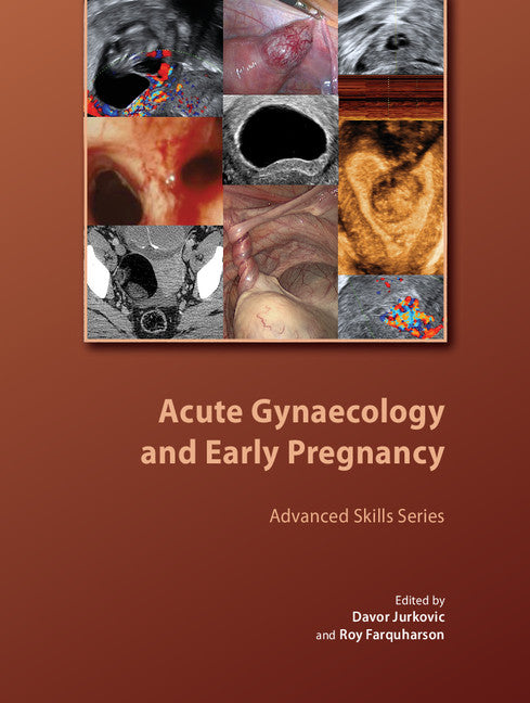 Acute Gynaecology and Early Pregnancy (Hardback) 9781906985325