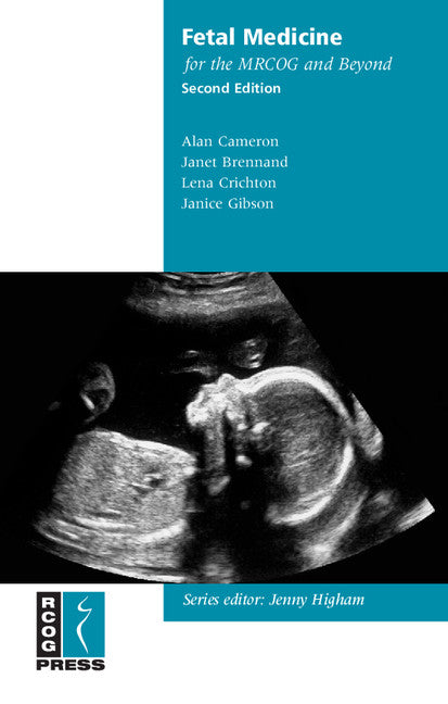 Fetal Medicine for the MRCOG and Beyond (Paperback / softback) 9781906985363