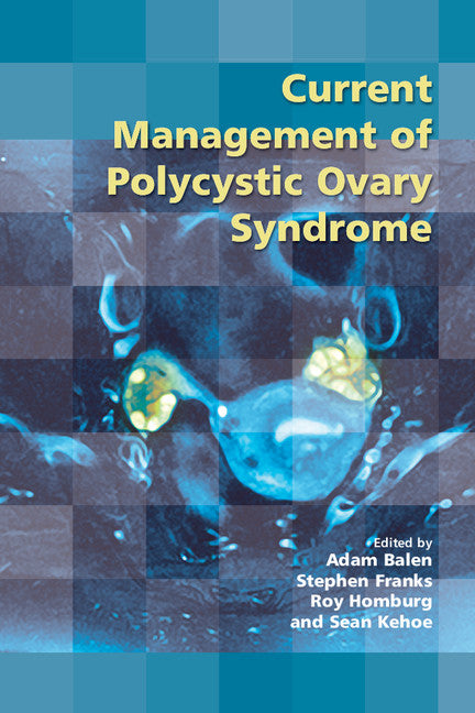 Current Management of Polycystic Ovary Syndrome (Paperback / softback) 9781906985417