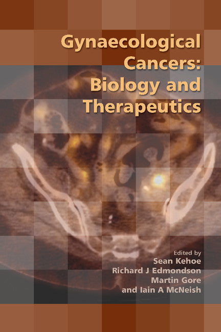 Gynaecological Cancers; Biology and Therapeutics (Paperback / softback) 9781906985448