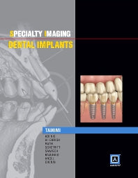 Specialty Imaging: Dental Implants (Hardback) 9781937242190